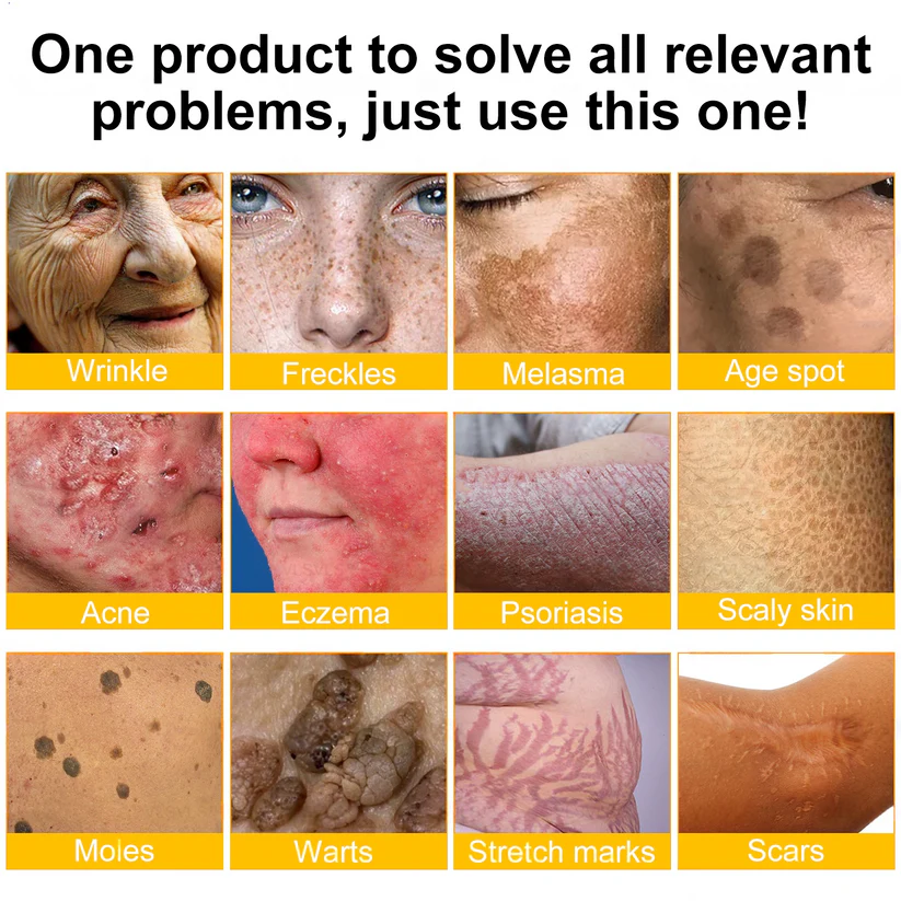 Made and Shipped from UK ✨  Solaroza® Bee Venom Skin Restoration Cream Powerful Anti-Aging. Zero Harm to Bees.⏰ LAST DAY 80% OFF💖