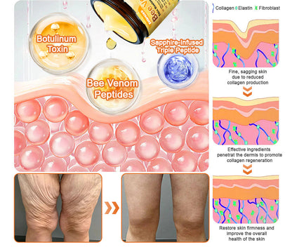 Made and Shipped from UK ✨  Solaroza® Bee Venom Skin Restoration Cream Powerful Anti-Aging. Zero Harm to Bees.⏰ LAST DAY 80% OFF💖