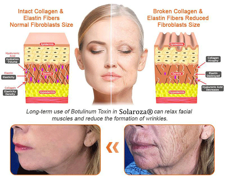 Made and Shipped from UK ✨  Solaroza® Bee Venom Skin Restoration Cream Powerful Anti-Aging. Zero Harm to Bees.⏰ LAST DAY 80% OFF💖