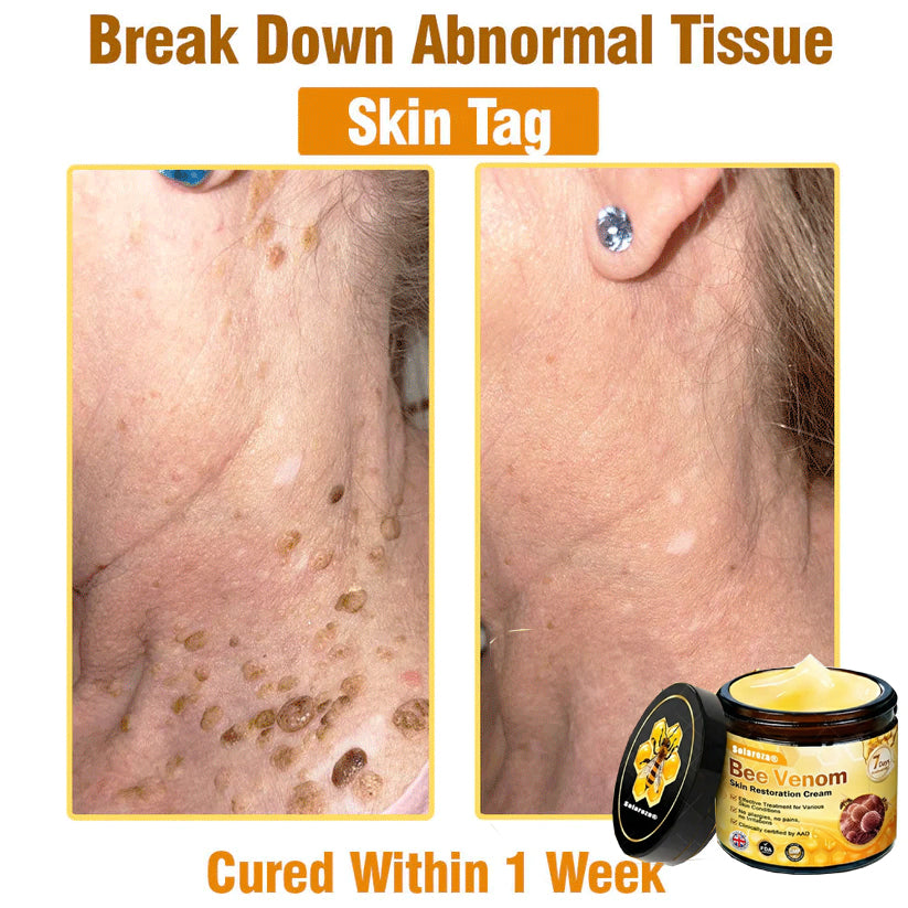 Made and Shipped from UK ✨  Solaroza® Bee Venom Skin Restoration Cream Powerful Anti-Aging. Zero Harm to Bees.⏰ LAST DAY 80% OFF💖