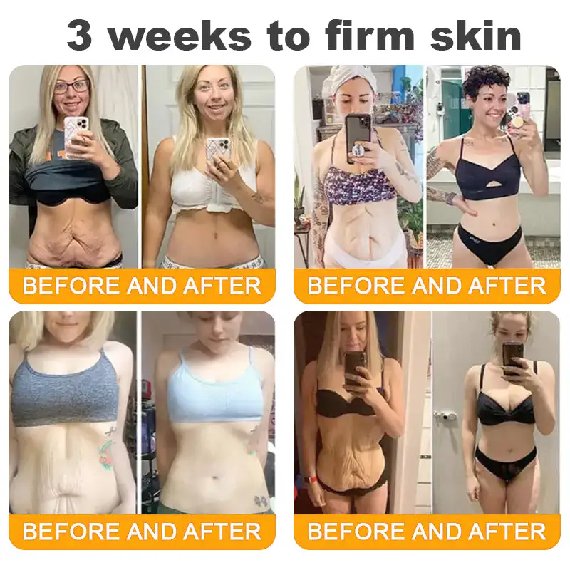 Made and Shipped from UK ✨  Solaroza® Bee Venom Skin Restoration Cream Powerful Anti-Aging. Zero Harm to Bees.⏰ LAST DAY 80% OFF💖