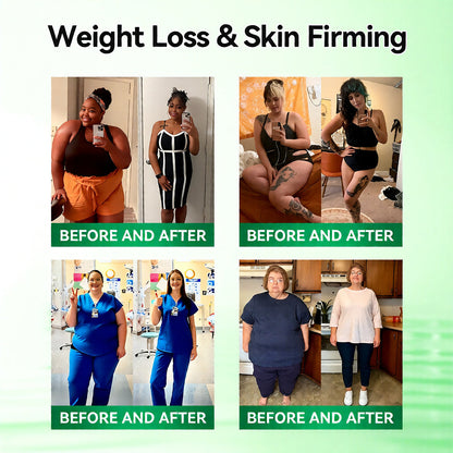 🌿Official Store | 🍋Solaroza® Moringa & Berberine 10-IN-1 Advanced Nano Microneedle 1 Patch (Once Daily, visible changes in 7 days) ✅ Obesity, Diabetes, Sleep Apnea, And Joint Issuess
