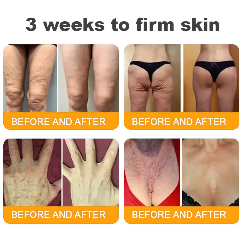 Made and Shipped from UK ✨  Solaroza® Bee Venom Skin Restoration Cream Powerful Anti-Aging. Zero Harm to Bees.⏰ LAST DAY 80% OFF💖