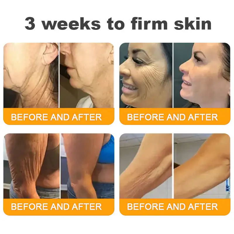 Made and Shipped from UK ✨  Solaroza® Bee Venom Skin Restoration Cream Powerful Anti-Aging. Zero Harm to Bees.⏰ LAST DAY 80% OFF💖